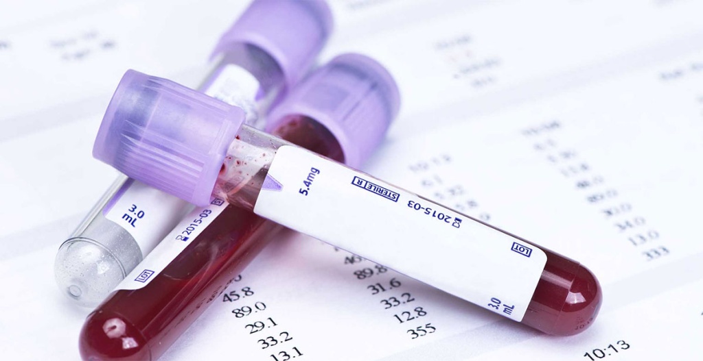 Какие анализы сдавать перед консультацией с нутрициологом